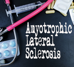 מחקר ישראלי חדש בתרופה לטיפול בחולי ALS-תמונה